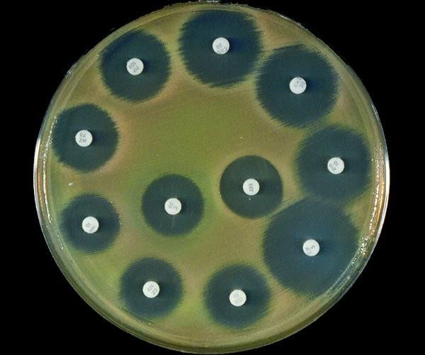 3410 Исследователи готовы к прорыву в борьбе с устойчивыми бактериями
