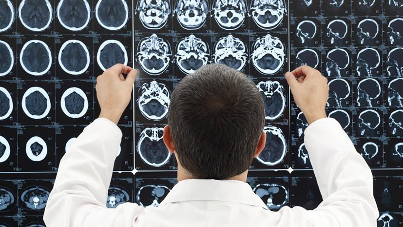 4572 Ученые заявили о вреде тяжелой физической работы для здоровья мозга