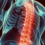 6446 Борьба с остеопорозом: как сделать кости более крепкими